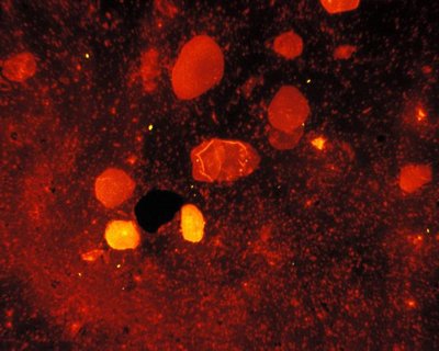 m-tuberculosis-is-an-acid-fast-bacterium-undetectable-when-stained-using-a-gram-stain-technique-725x490.jpg