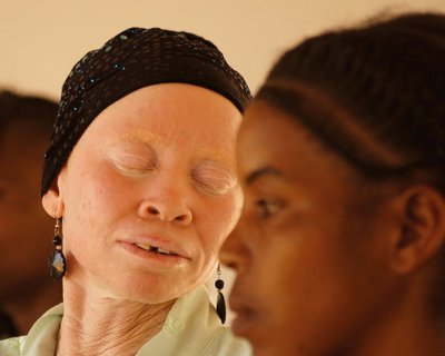 Tanzania Albinism Collective - White African Power